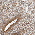 Immunohistochemical staining of human endometrium shows strong cytoplasmic positivity in stromal cells and membranous staining in glandular cells.