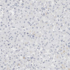 Anti-P4HA2 Antibody