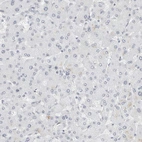 Immunohistochemical staining of human liver shows negative cytoplasmic positivity in hepatocytes.