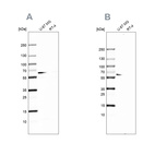 Western blot analysis using Anti-P4HA2 antibody HPA027824 (A) shows similar pattern to independent antibody HPA016997 (B).