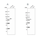 Western blot analysis using Anti-P4HA2 antibody HPA027824 (A) shows similar pattern to independent antibody HPA016997 (B).