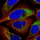 Immunofluorescent staining of human cell line U-2 OS shows localization to endoplasmic reticulum & vesicles.
