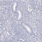 Anti-TSSK1B Antibody