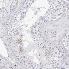 Immunohistochemical staining of human testis shows high expression.