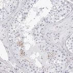 Immunohistochemical staining of human testis shows high expression.