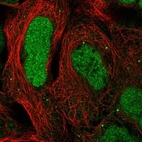 Anti-CAMTA2 Antibody