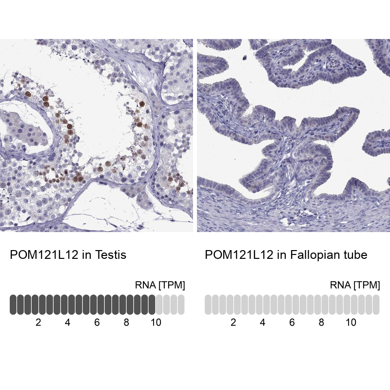 Anti-POM121L12 Antibody