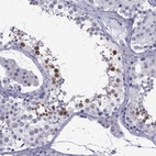 Immunohistochemical staining of human testis shows high expression.