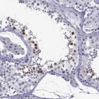Immunohistochemical staining of human testis shows high expression.