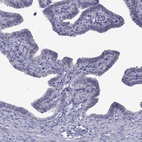Immunohistochemical staining of human fallopian tube shows low expression as expected.