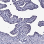 Immunohistochemical staining of human fallopian tube shows low expression as expected.