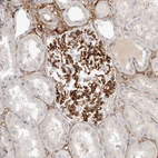 Anti-LRRC66 Antibody