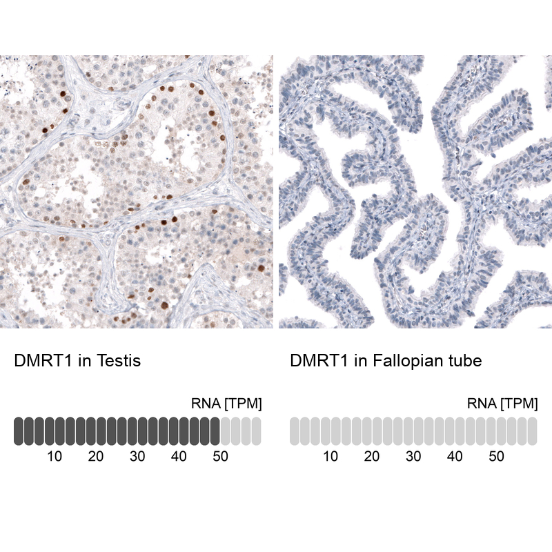 Anti-DMRT1 Antibody
