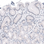 Immunohistochemical staining of human stomach shows no positivity in glandular cells as expected.