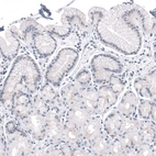 Immunohistochemical staining of human stomach shows no positivity in glandular cells as expected.