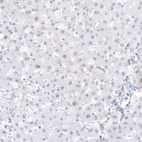 Immunohistochemical staining of human liver shows no positivity in hepatocytes as expected.