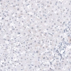Immunohistochemical staining of human liver shows no positivity in hepatocytes as expected.