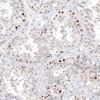 Immunohistochemical staining of human testis shows strong nuclear positivity in a subset of cells in seminiferous ducts.
