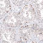 Immunohistochemical staining of human testis shows strong nuclear positivity in a subset of cells in seminiferous ducts.