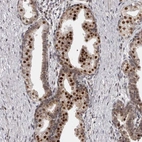 Anti-THUMPD1 Antibody