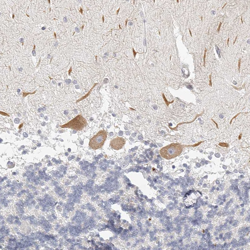 Rabbit Polyclonal AntiITGB3 Antibody Buy for research Highly