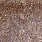 Anti-STAT5A Antibody