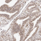 Immunohistochemical staining of human Fallopian tube shows weak cytoplasmic positivity in glandular cells.