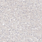 Immunohistochemical staining of human liver shows no positivity in hepatocytes as expected.