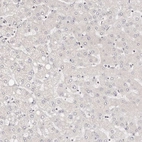 Immunohistochemical staining of human liver shows no positivity in hepatocytes as expected.