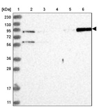 Lane 1: Marker [kDa] 230, 130, 95, 72, 56, 36, 28, 17, 11_br/_Lane 2: Human cell line RT-4_br/_Lane 3: Human cell line U-251MG sp_br/_Lane 4: Human plasma (IgG/HSA depleted)_br/_Lane 5: Human liver tissue_br/_Lane 6: Human tonsil tissue