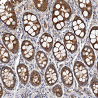 Immunohistochemical staining of human colon shows moderate cytoplasmic positivity in glandular cells.