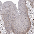 Immunohistochemical staining of human skin shows moderate cytoplasmic positivity in epidermal cells.