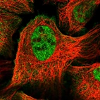 Immunofluorescent staining of human cell line U-2 OS shows localization to nucleoplasm & plasma membrane.