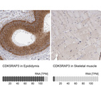 Anti-CDK5RAP3 Antibody