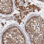 Immunohistochemical staining of human testis shows strong cytoplasmic positivity in cells in seminiferous ducts and leydig cells.