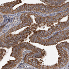 Immunohistochemical staining of human fallopian tube shows strong cytoplasmic positivity in glandular cells.
