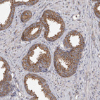 Immunohistochemical staining of human prostate shows strong cytoplasmic positivity in glandular cells.