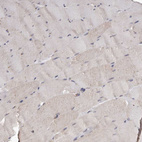 Immunohistochemical staining of human skeletal muscle shows weak cytoplasmic positivity in myocytes.