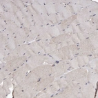 Immunohistochemical staining of human skeletal muscle shows weak cytoplasmic positivity in myocytes.
