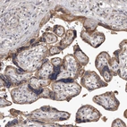 Immunohistochemical staining of human placenta shows weak to moderate membranous and cytoplasmic positivity in trophoblastic cells.