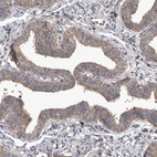 Immunohistochemical staining of human fallopian tube shows weak to moderate membranous 
 and cytoplasmic positivity in glandular cells.
