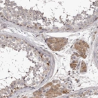 Immunohistochemical staining of human testis shows moderate cytoplasmic positivity in Leydig cells.