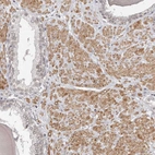 Immunohistochemical staining of human prostate shows moderate positivity in nuclear membrane and cytoplasm in smooth muscle cells.