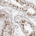 Immunohistochemical staining of human testis shows strong positivity in nuclear membrane in cells in seminiferous ducts.