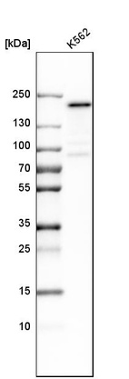 Western blot analysis in human cell line K562.