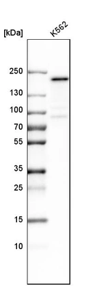 Western blot analysis in human cell line K562.