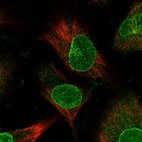 Immunofluorescent staining of human cell line U-251 MG shows localization to nuclear membrane.
