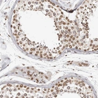 Anti-NUP153 Antibody