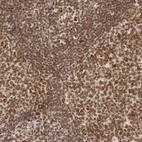 Immunohistochemical staining of human lymphoid tissues shows strong positivity in nuclear membrane in germinal center cells and non-germinal center cells.
