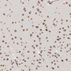 Immunohistochemical staining of human cerebral cortex shows strong positivity in nuclear membrane in neurons.